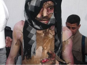 رائحة الجلد البشري المحروق.. رائحة الجلد البشري المحروق..