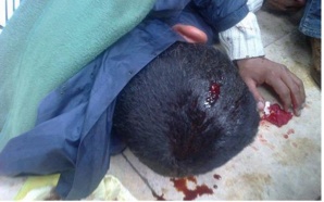 بلاغ حول المجزرة التي اركبها الأمن المغربي ضد المعطلين وخرقة لاتفاق جنيف المتعلق بحماية التظاهر السلمي بلاغ حول المجزرة التي اركبها الأمن المغربي ضد المعطلين وخرقة لاتفاق جنيف المتعلق بحماية التظاهر السلمي