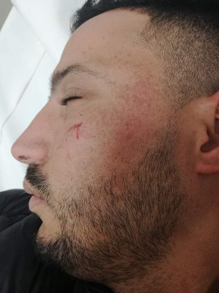 الشغل بقطاع الفوسفاط بابن جرير ليس لأبناء المنطقة....من نصيبهم الهراوة......! الشغل بقطاع الفوسفاط بابن جرير ليس لأبناء المنطقة....من نصيبهم الهراوة......!