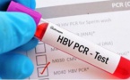 الحكومة تقرر إعفاء الراغبين في القدوم إلى المغرب من اختبار "PCR"